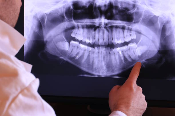 Best Emergency Root Canal Treatment in West Liberty, OH