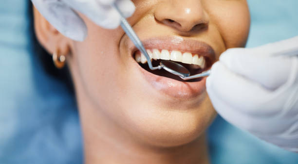 Best Urgent Care for Lost Fillings or Crowns in West Liberty, OH